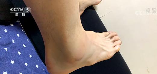 坏消息！广东宏远队长国家队训练脚踝严重扭伤，其一表现令球迷们感动！(1)