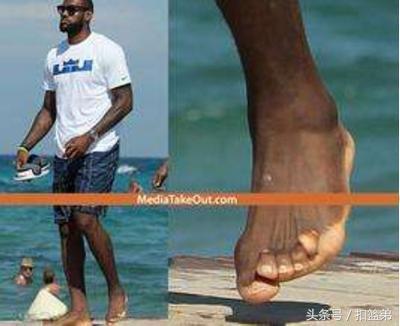 nba球员的脚 看看NBA球星的脚(4)