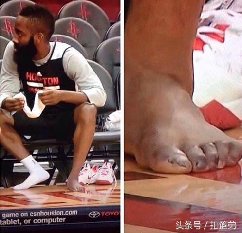 nba球员的脚 看看NBA球星的脚(8)