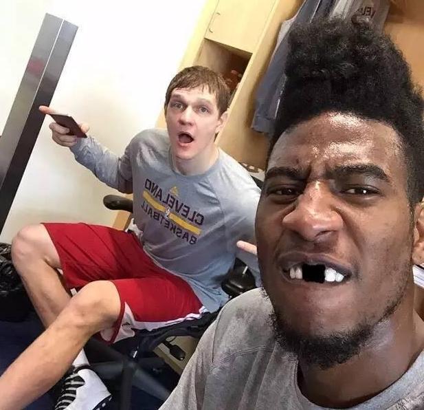 nba球员牙齿被打掉 NBA门牙被打掉六大瞬间(5)