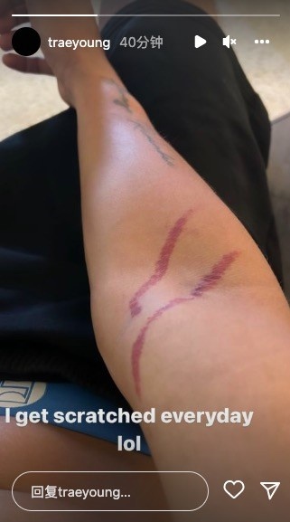 特雷杨晒与库里欧文合照 打野球手臂被抓伤：两道血印子太明显(6)
