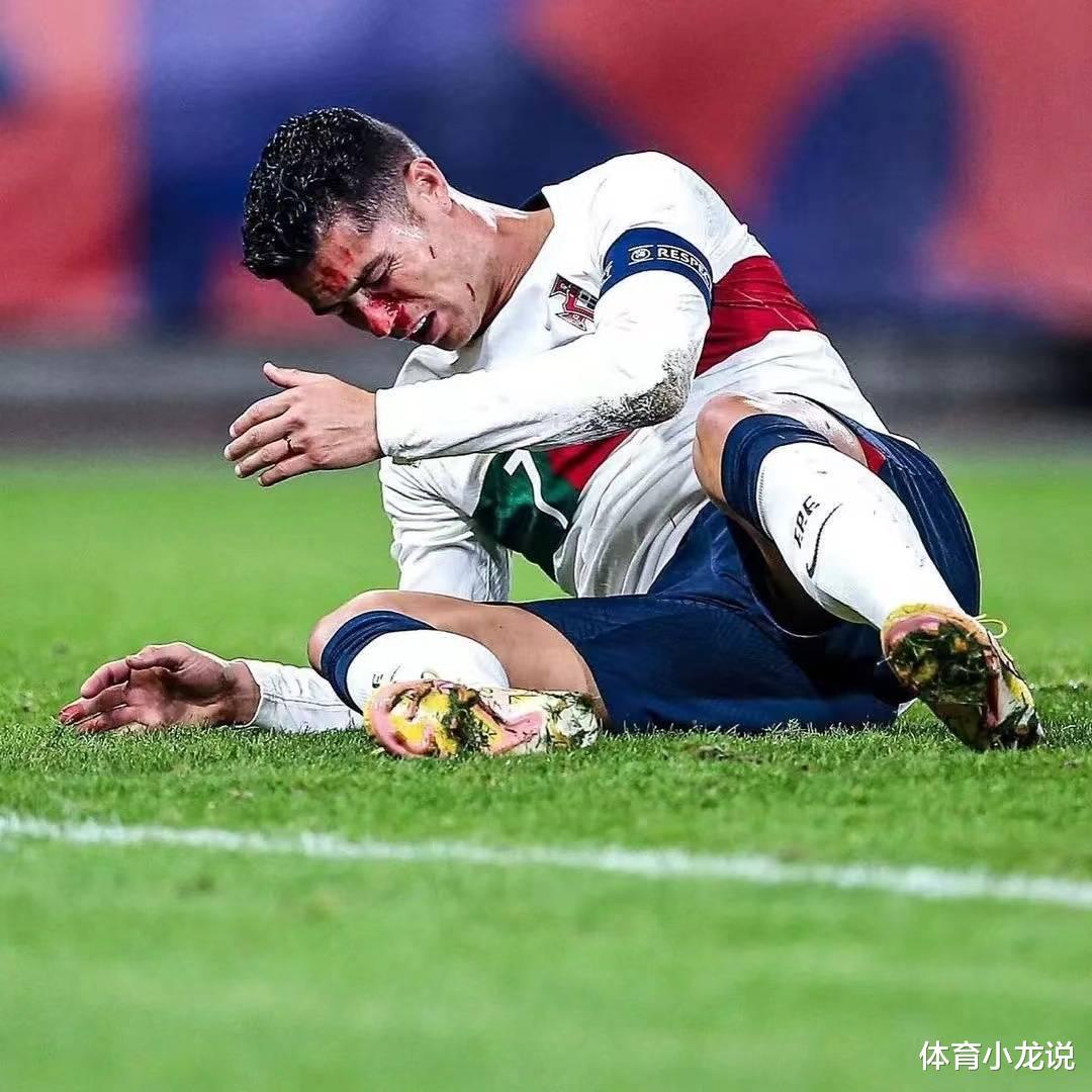 遗憾！豪门主力遭重伤，或错过世界杯，球员本人却不愿手术？